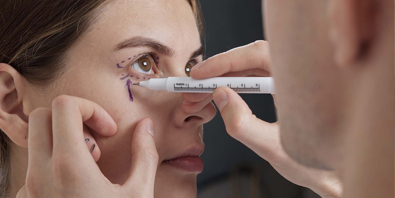 Blepharoplasty South Florida Eyelid Surgery Delray Beach